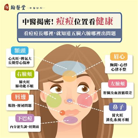 痘痘位子|眉毛、人中長痘痘的原因？10個「青春痘位置」對應你。